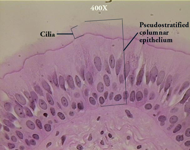 Image result for pseudostratified epithelium labeled