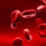 Hemophilia & Thrombocytopenia